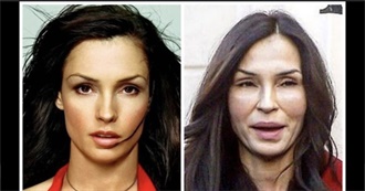 25 Celebrities Who&#39;ve Destroyed Their Faces With Plastic Surgery