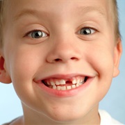 Losing Your First Tooth