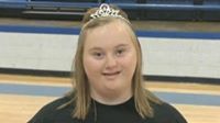 Homecoming Queen Inspires Classmates