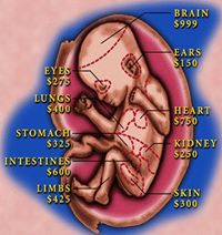 Defend Pre-Born Babies (Pro-Babies)