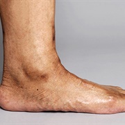 Ankle