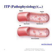 Immune Thrombocytopenic Purpura (ITP)