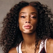 Winnie Harlow