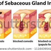 Sebaceous