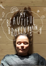 My Beautiful Broken Brain (2014)