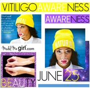 Vitiligo Day (June 25)