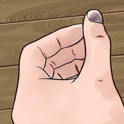 Finger Slammed in Door