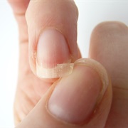 Broke a Fingernail