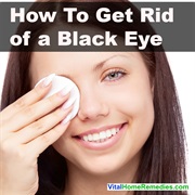 Black Eye