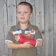 Have You Ever Broken a Bone?