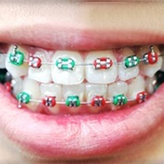 Worn Braces