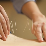 Tried Acupuncture