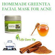 Green Tea for Acne