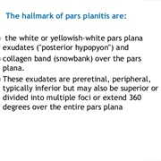 Pars Planitis (Peripheral Uveitis)