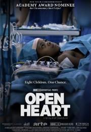 Open Heart
