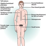 Klinefelter Syndrome