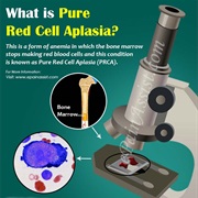Pure Red Cell Aplasia (PRCA)