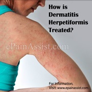 Dermatitis Herpetiformis