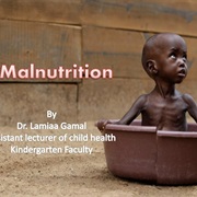 Malnutrition