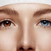 Heterochromia Iridis