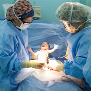 First Successful Caesarean Section Birth - 1500