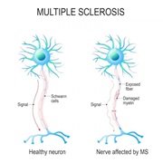 Multiple Sclerosis Awareness Month (March)