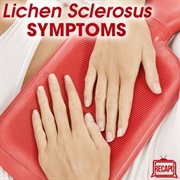 Lichen Sclerosus