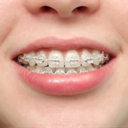 Braces