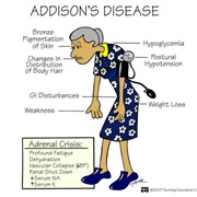 Addison&#39;s Disease