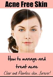 Your Best Guide to Acne-Free Skin