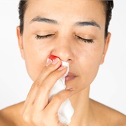 Nose Bleed