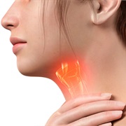 Laryngeal (Larynx) Cancer