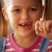 Lose a Tooth