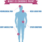 Chronic Pain