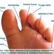 Treat Athlete's Foot