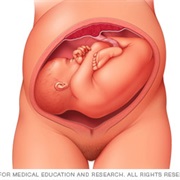 Transverse Position During Birth