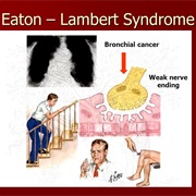 Lambert-Eaton Syndrome