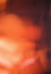 Scenes From Under Childhood (I-IV)