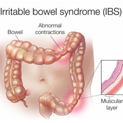 IBS