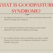 Goodpasture's Syndrome