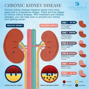 Chronic Kidney Disease
