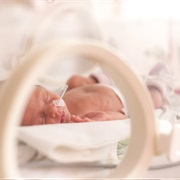 Premature Baby