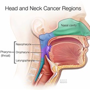 Head and Neck Cancer