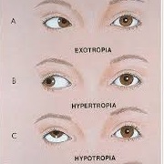 Thom Yorke's Lazy Eye