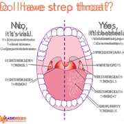 Strep Throat