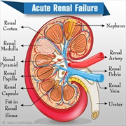 Renal Failure