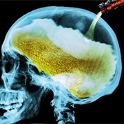 Alcohol Directly Kills Brain Cells