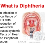 Diptheria