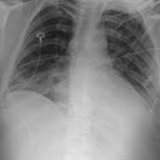 Invention of Radiologic Imaging - 1895