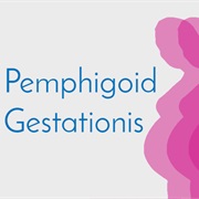 Herpes Gestationis or Pemphigoid Gestationis (PG)